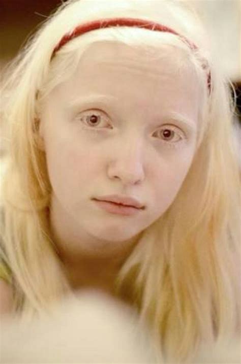 Pinterest Albino Model Beautiful Skin Ethereal Beauty