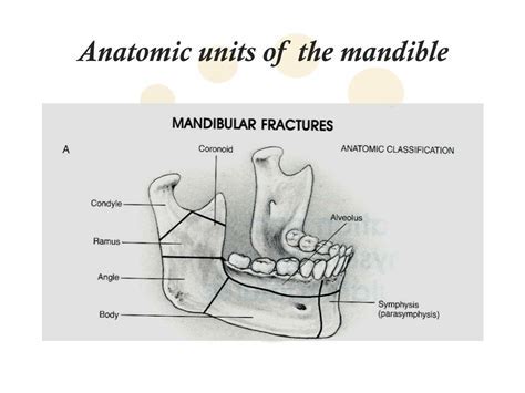 Ppt Anatomy And Fractures Of The Mandible Powerpoint Presentation My XXX Hot Girl