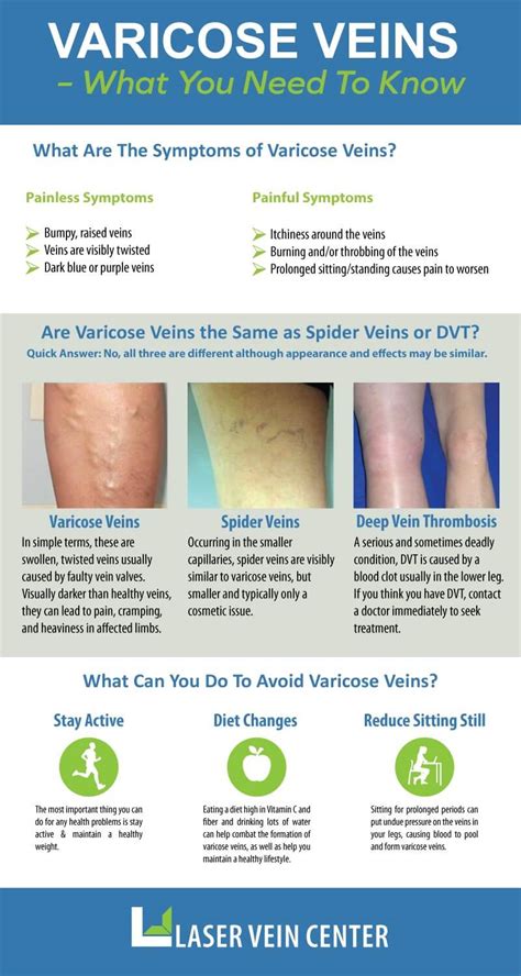 Varicose Veins What You Need To Know Laser Lipo