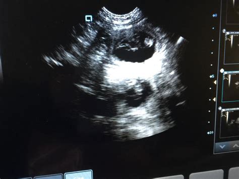 Pregnant Dog Ultrasound