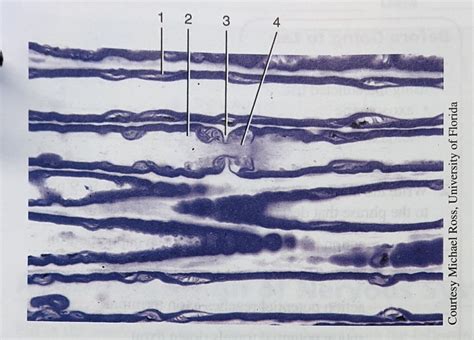 Teased Myelinated Axon Diagram Quizlet