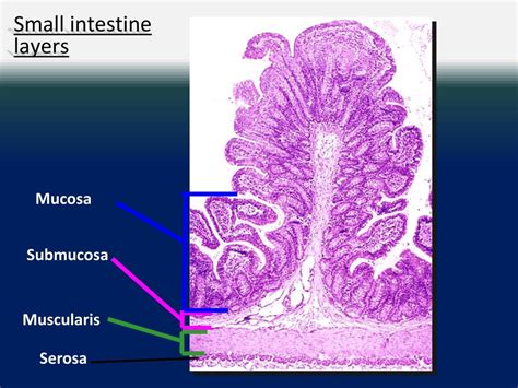 Mucosa Submucosa Muscular E Serosa