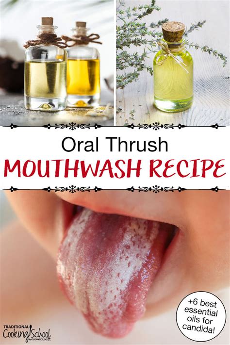 6 Essential Oils For Candida Oral Thrush Mouthwash Recipe
