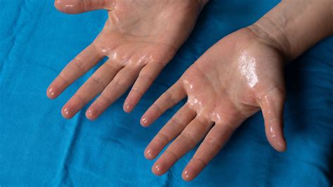 Here's Why Your Hands Are Going Clammy