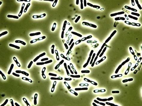 Bacillus Cereus Scientists Find Way To Detect Food Bug News The Grocer
