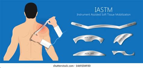 instrument assisted soft tissue mobilization iastm stock vector royalty free 1469204930