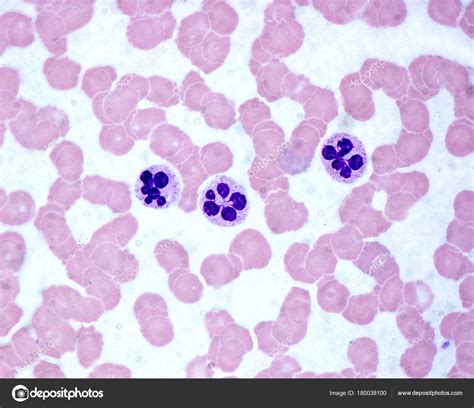 Neutrofiele Granulocyten Bloed Uitstrijkje ⬇ Stockfoto Rechtenvrije