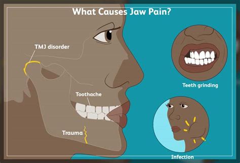 Ways To Cope With Misaligned Jaw Pain Dentist Ahmed