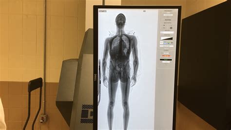Full Body Scanner To Detect Weapons Drugs In Use At Morris County Jail
