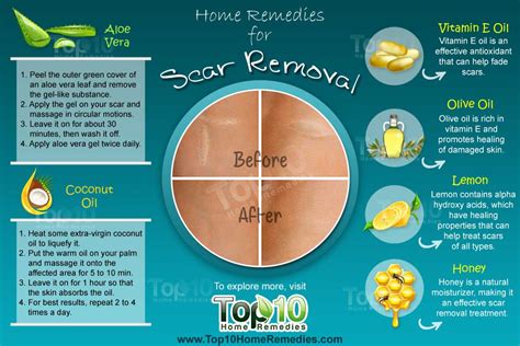 Dilute 2 drops of tea tree oil with a few drops of a carrier oil like coconut oil and dab it on the pimple. Home Remedies for Scar Removal | Top 10 Home Remedies