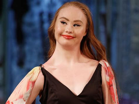 This Model With Down Syndrome Is Taking The Fashion Industry By Storm