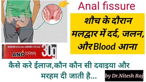 Anal Fissure Anal Pain Anal Bleedinganal Fissure Vs Pilescauses And