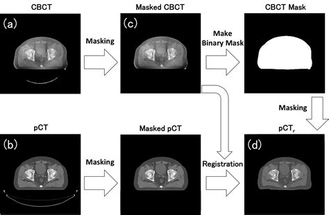 Cone Beam Computed Tomography Image Quality Improvement Using A Deep Convolutional Neural