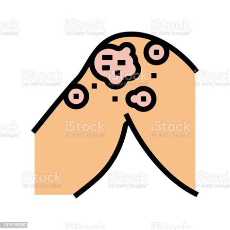 Atopic Dermatitis Color Icon Vector Illustration Stock Illustration