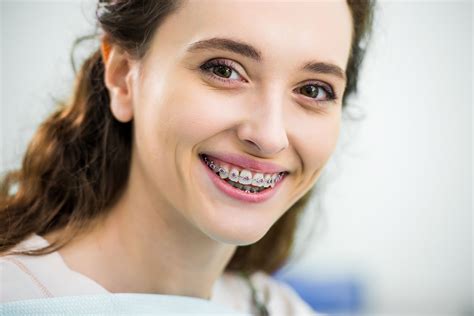 Adult Braces Prices And Orthodontics Types Bitbitbyte