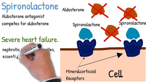 Spironolactone Mechanism Of Action Use And Side Effects Simply