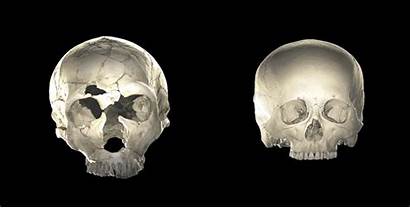 Neanderthal Human Dna Brain Humans Modern Skull