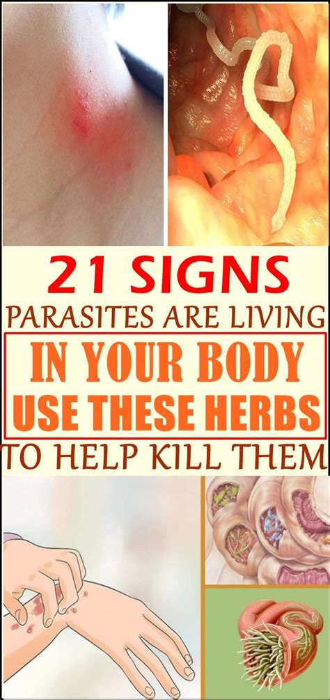 21 Signs That Your Body Is Full Of Parasites Wellness Magazine