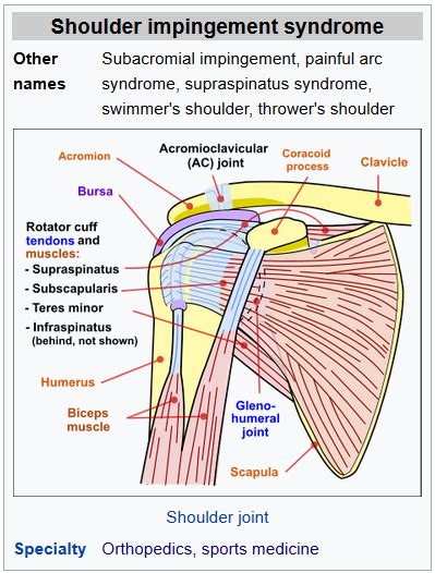 Shoulder impingement is a progressive orthopedic condition that occurs as a result of altered biomechanics and/or structural abnormalities. Shoulder Impingement Physiotherapy