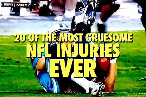 Head injuries, which carry a great risk of. Total Pro Sports 20 of the Most Gruesome NFL Injuries Ever