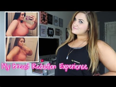 Breast Reduction Before And After In Clothes