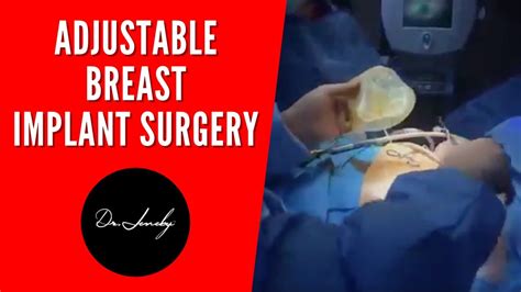 Adjustable Breast Augmentation Surgery San Antonio Tx Youtube