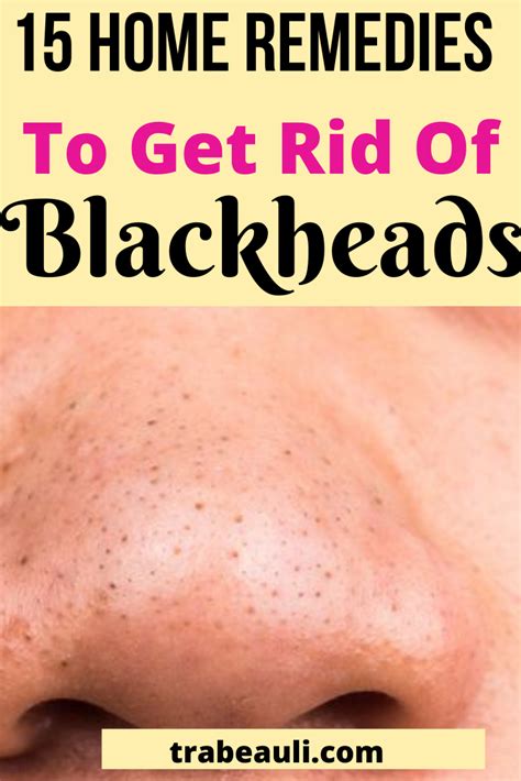 How To Get Rid Of Blackheads On Nose Permanently Home Remedies Howtoremvo