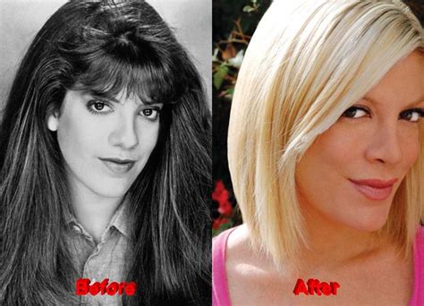 Tori Spelling Plastic Surgery Before After Cumception