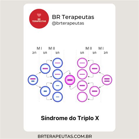 O Que é A Síndrome Do Triplo X Br Terapeutas