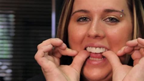 See How The Dentist Ruined Her Teeth Press On Veneer Client Tells Us