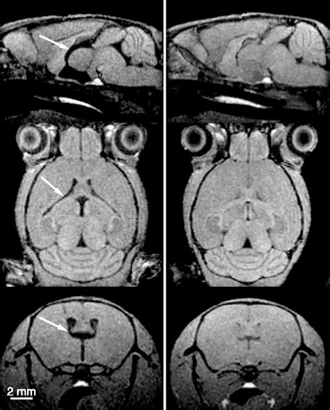 Figure 5 From High Resolution 3d Mri Of Mouse Brain Reveals Small