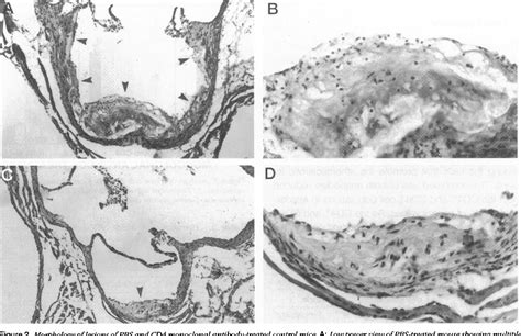 Figure 2 From Inhibition Of Atherosclerosis In CD4 T Cell Ablated And