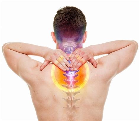 Cervical Radiculopathy Back Pain Archives Positive Life
