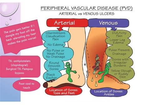 Venous ulcers vs arterial ulcers. Nclex, Emergency department and Signs on Pinterest
