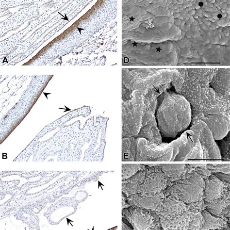 A Renal Papilla Top With Single Cell Layer Lining Epithelium