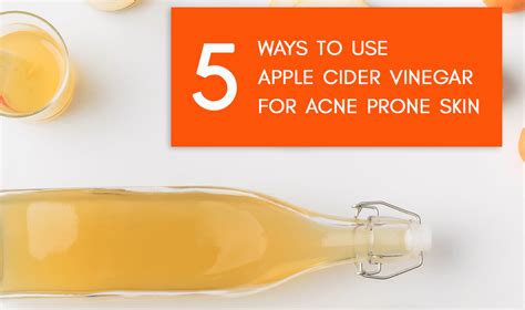 5 Recipes To Use Apple Cider Vinegar For Acne Urban Gyal