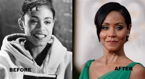 Jada Pinkett Smith Photos Before And After Plastic Surgery Plastic