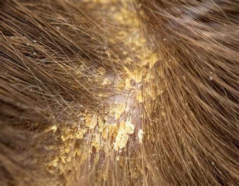 What Is The Most Common Bacterial Skin Infection In Dogs
