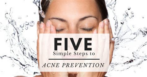 5 Simple Steps To Acne Prevention Beauty Bedazzled