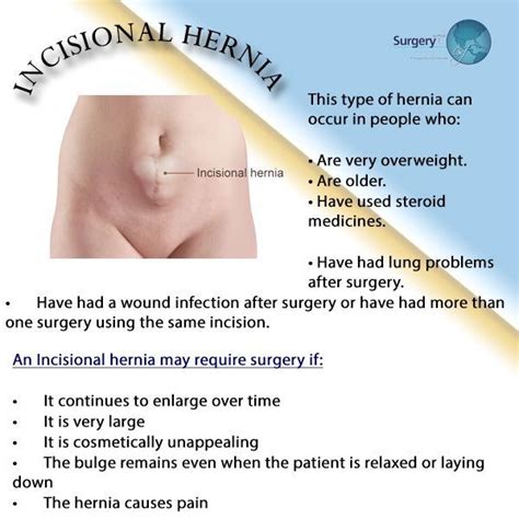 Pin On Hernia Information