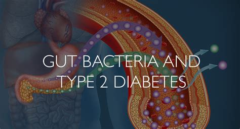 Gut Bacteria And Type 2 Diabetes Clinical Education