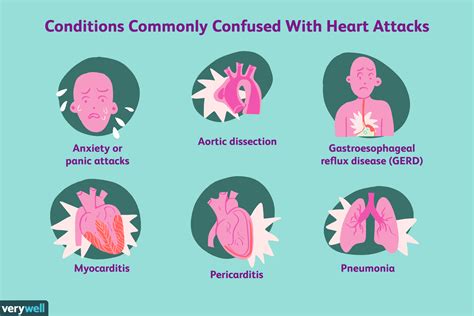 Wie Ein Herzinfarkt Diagnostiziert Wird