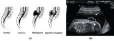 The Embryologic Perspective Anatomy