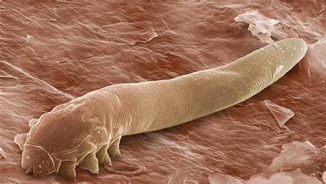 Face Mites Have Evolved With Humans — And Can Tell Us About Our
