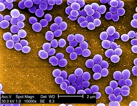 Free Picture Staphylococcus Aureus Bacteria Vancomycin Intermediate