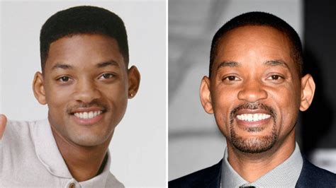 Will Smiths Plastic Surgery Is Making Rounds On The Internet