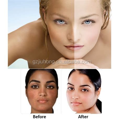 New Arrival Spot Removal Pearl Skin Whitening Cream Thailand Buy Skin