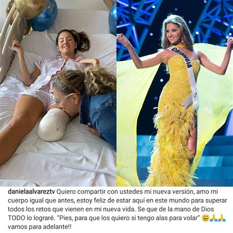 Ex Miss Colombia Revela Amputación De Pie Tras 5 Cirugías Golfo Pacífico