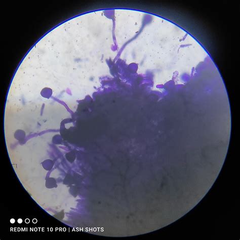Pollen Tube Growth On Stigma Expt Biology Notes Teachmint
