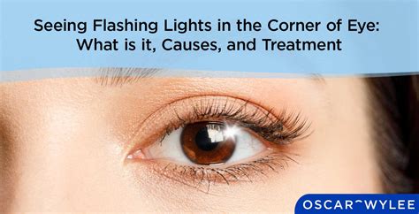 Seeing Flashing Lights In The Corner Of Eye What Is It Causes And